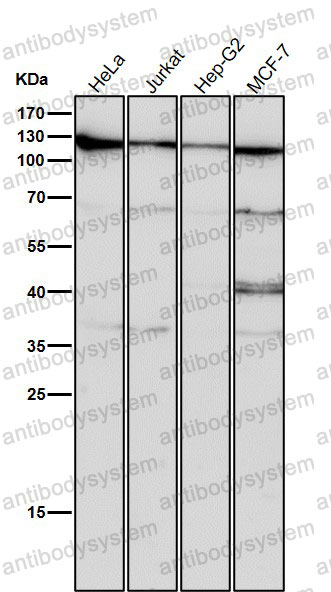 Anti-XPO1 Antibody (R1D44)