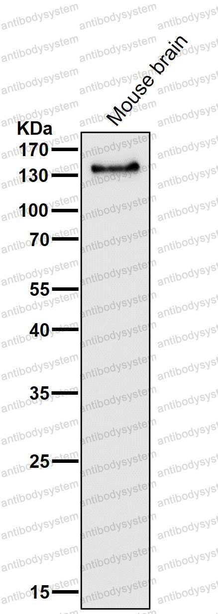 Anti-PER2 Antibody (R1D46)
