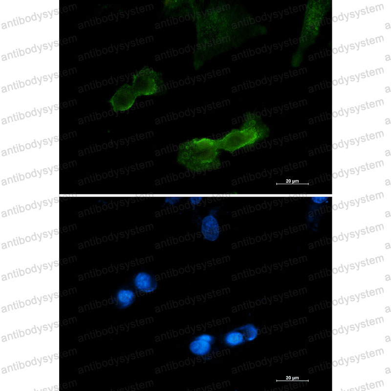 Anti-DCLK1 Antibody (R1D48)