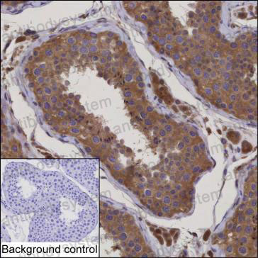 Immunohistochemical for Anti-CEP290 Antibody (R2U30) ?>