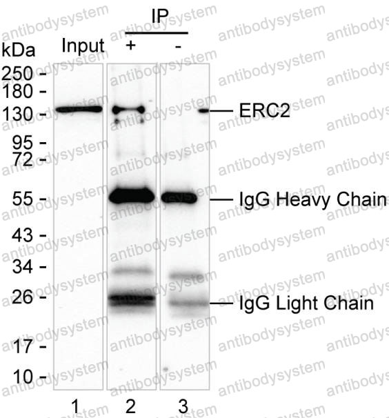 Immunoprecipitation for Anti-ERC2 Antibody (R2U32) ?>