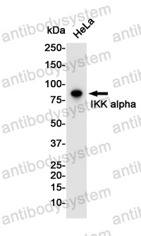 Anti-CHUK Antibody (R1D50)