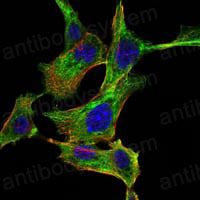 Immunofluorescence for Anti-CHUK Antibody (R2U34) ?>