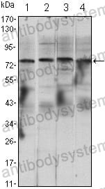 Western blot for Anti-CHUK Antibody (R2U34) ?>