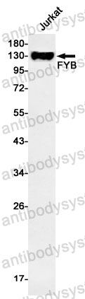 Anti-FYB1 Antibody (R1D52)