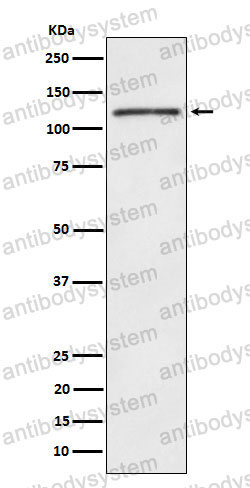 Anti-FYB1 Antibody (R1D51)