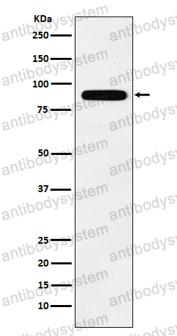 Anti-TBX3 Antibody (R1D53)