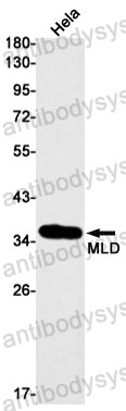 Anti-DEGS1 Antibody (R1D56)