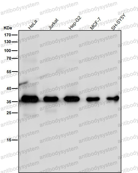 Anti-DEGS1 Antibody (R1D55)