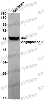 Anti-ANGPT2/Ang2 Antibody (R1D58)