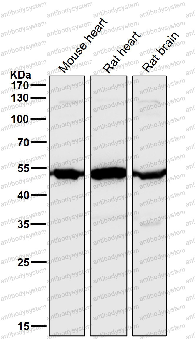 Anti-ANGPT2/Ang2 Antibody (R1D57)