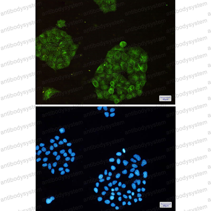 Anti-ARPC2 Antibody (R1D60)