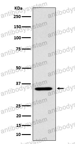 Anti-ARPC2 Antibody (R1D59)
