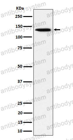 Anti-TRIM24 Antibody (R1D62)