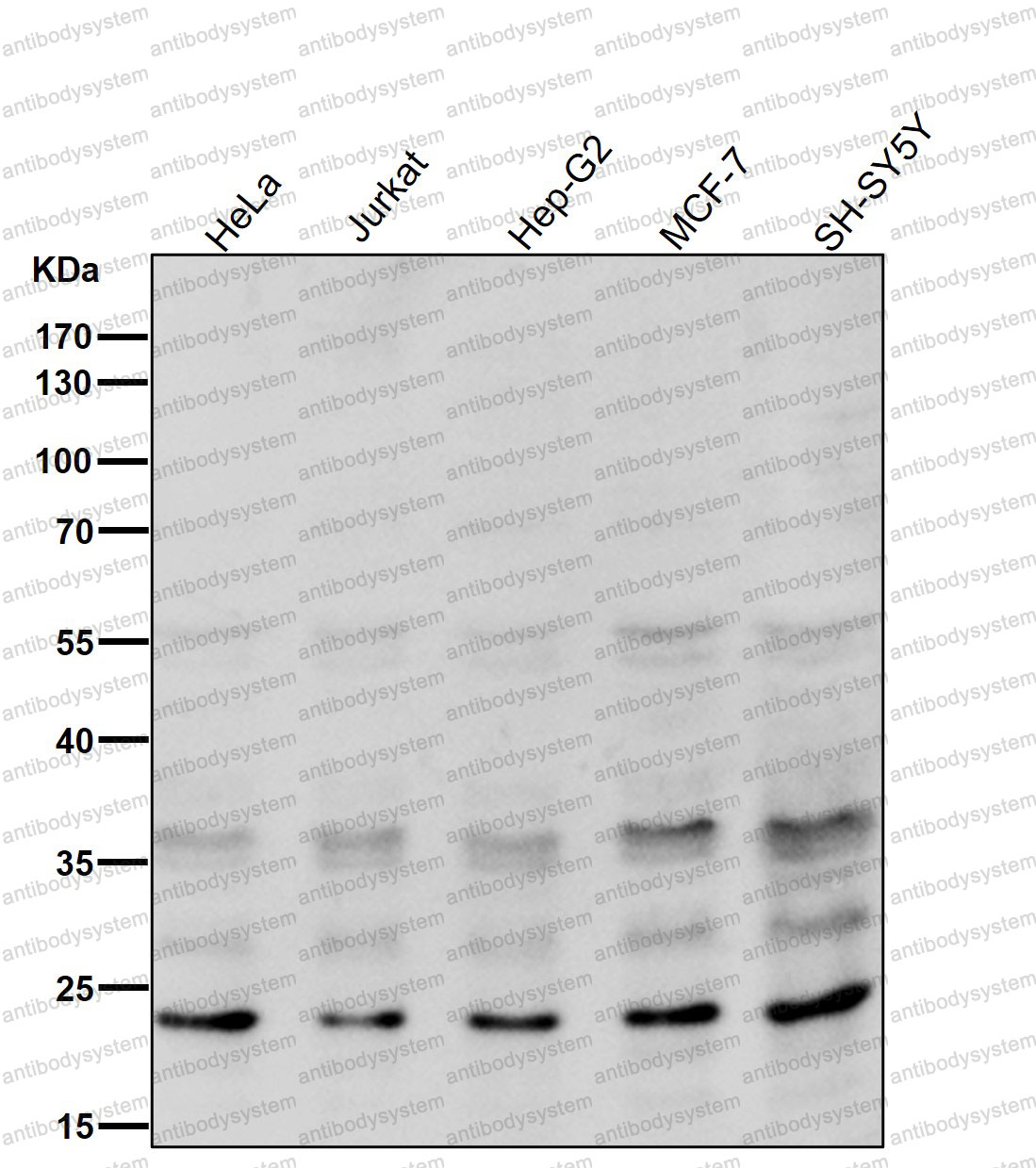 Anti-UBD Antibody (R1D64)