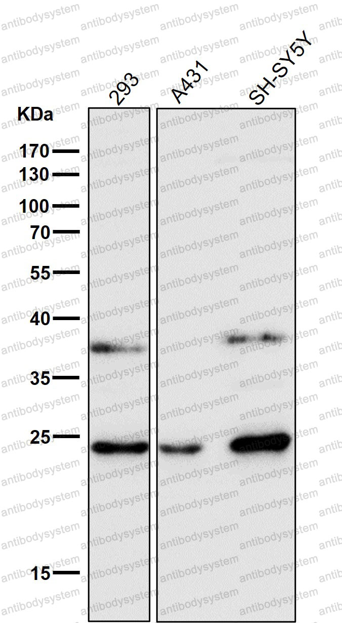 Anti-GSTA4 Antibody (R1B73)