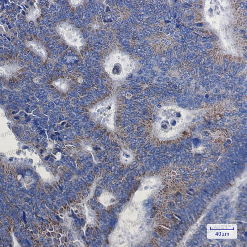Anti-NDUFA1 Antibody (R1D67)