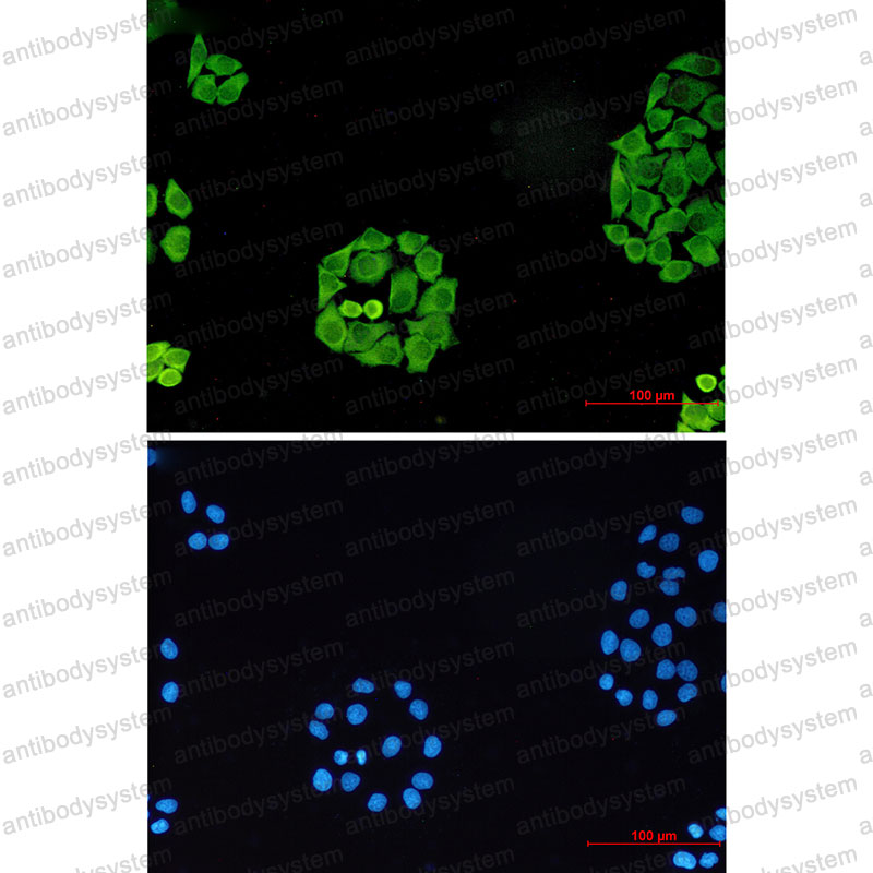 Anti-SURF4 Antibody (R1D68)
