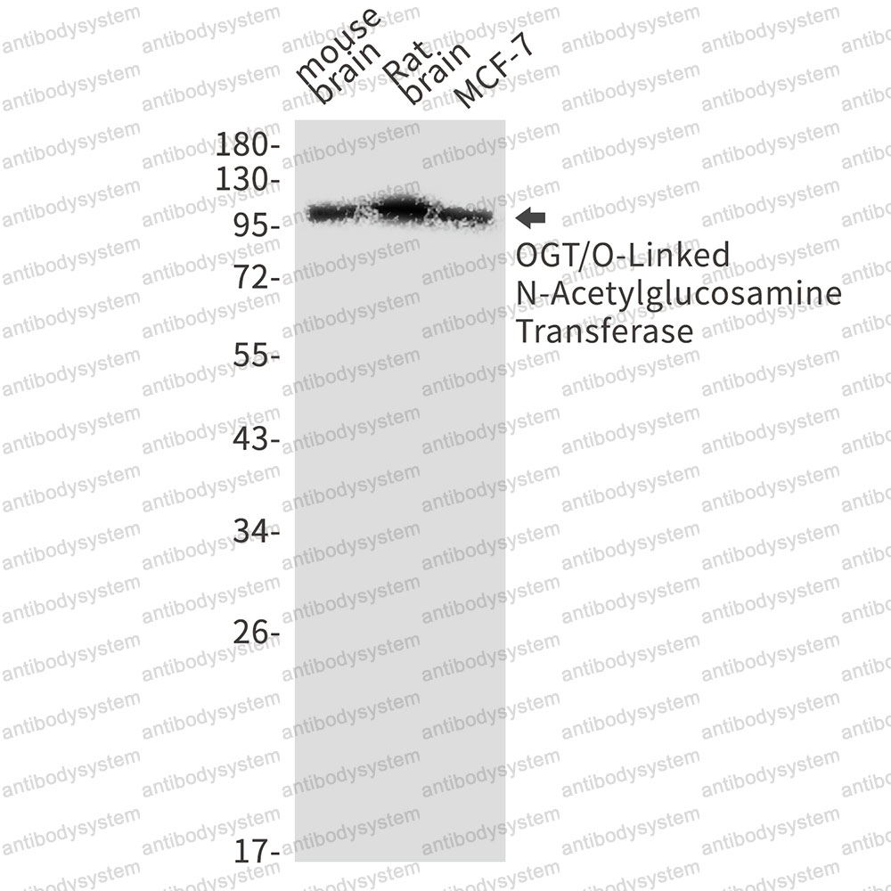 Anti-OGT Antibody (R1D70)