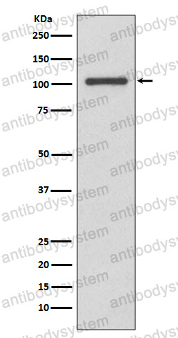 Anti-INPP4B Antibody (R1D71)