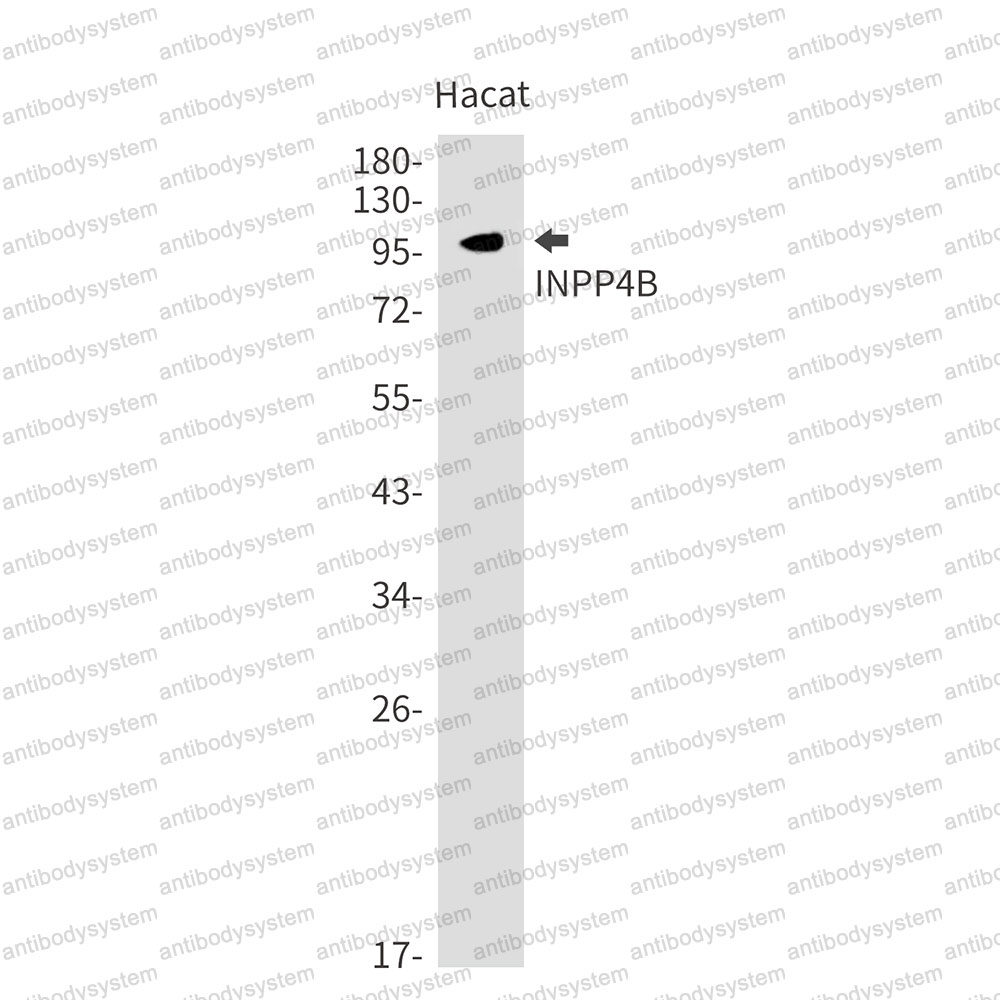 Anti-INPP4B Antibody (R1D72)