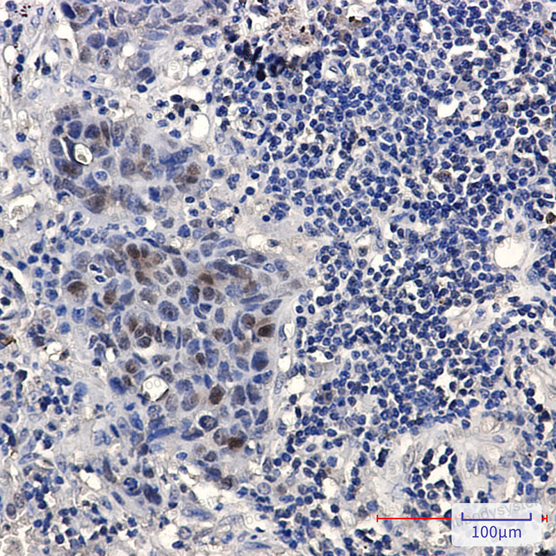 Anti-HMGB3 Antibody (R1D74)