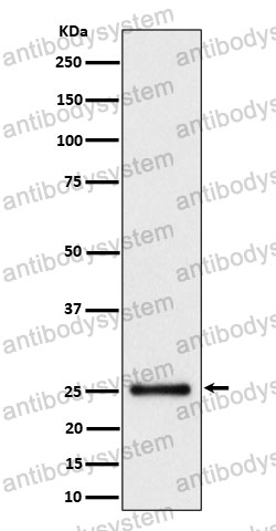 Anti-HMGB3 Antibody (R1D73)