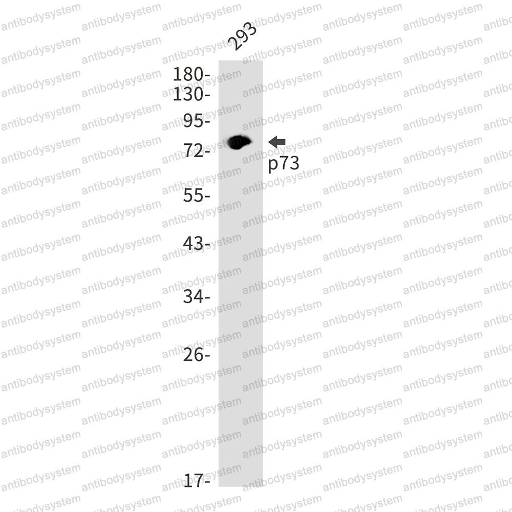 Anti-TP73 Antibody (R1D76)
