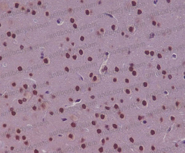 Anti-TP73 Antibody (R1D75)