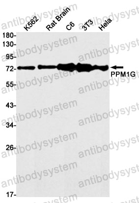 Anti-PPM1G Antibody (R1D80)