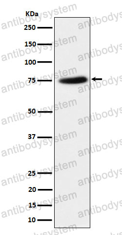 Anti-PPM1G Antibody (R1D78)
