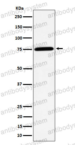 Anti-PPM1G Antibody (R1D79)