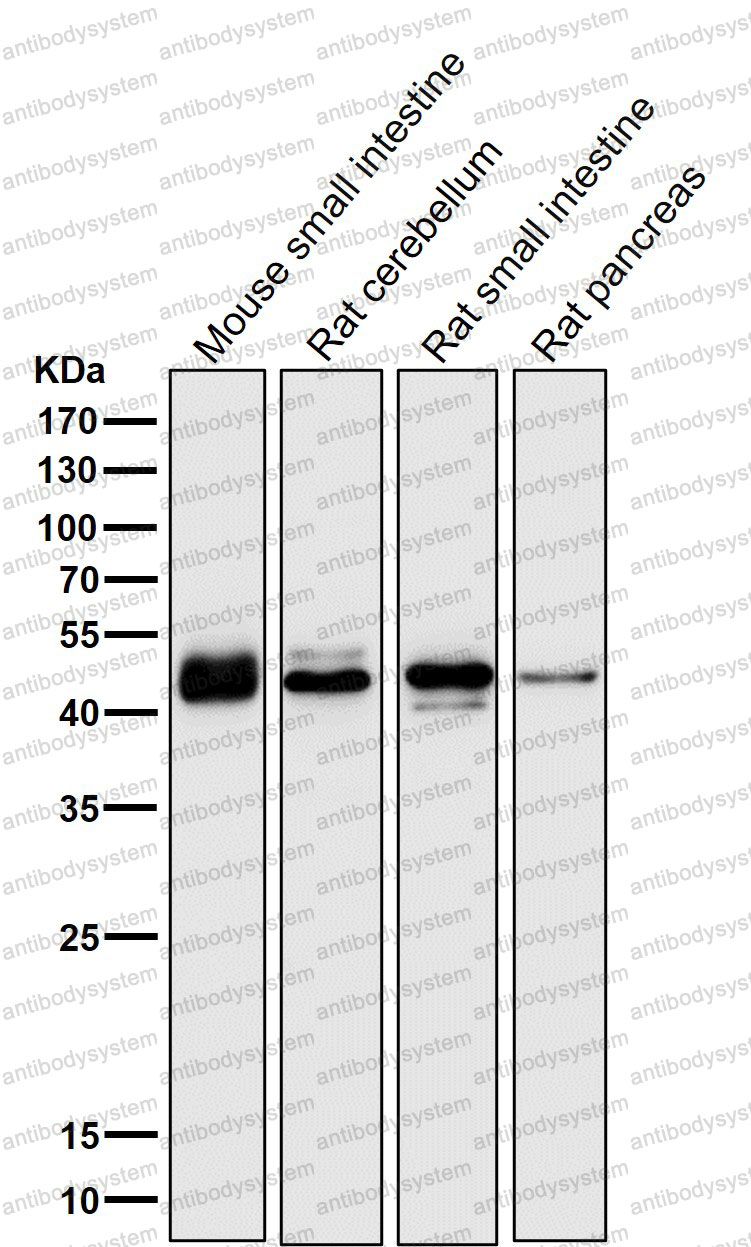 Anti-TMPRSS2 Antibody (R1D84)