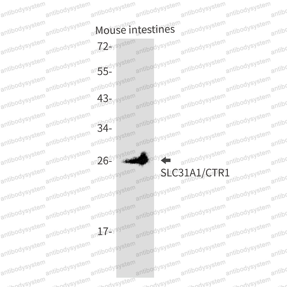 Anti-SLC31A1 Antibody (R1D86)