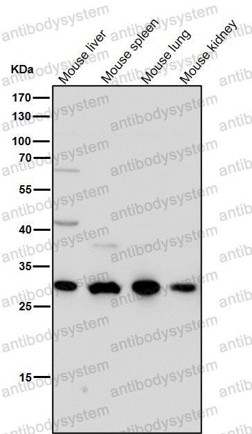 Anti-CTR1/SLC31A1 Antibody (R1D85)