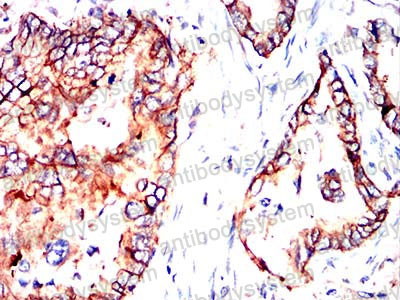 Immunohistochemical for Anti-ABCC3/MRP3 Antibody (R2U63) ?>
