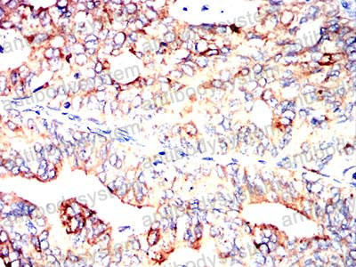 Immunohistochemical for Anti-ABCC3/MRP3 Antibody (R2U63) ?>