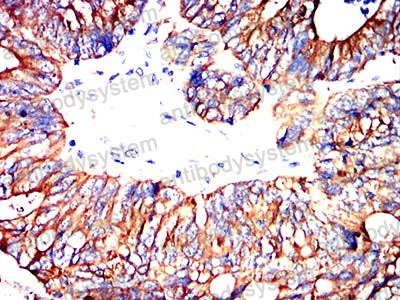 Immunohistochemical for Anti-ABCC3/MRP3 Antibody (R2U63) ?>