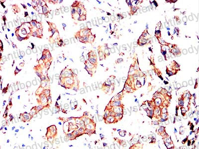 Immunohistochemical for Anti-ABCC3/MRP3 Antibody (R2U63) ?>