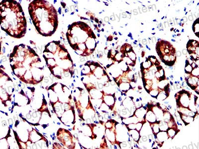 Immunohistochemical for Anti-ABCC3/MRP3 Antibody (R2U63) ?>