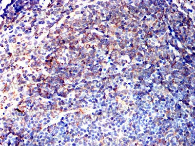 Immunohistochemical for Anti-ABCC3/MRP3 Antibody (R2U63) ?>
