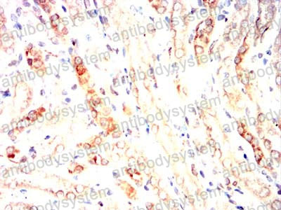 Immunohistochemical for Anti-ABCC3/MRP3 Antibody (R2U63) ?>