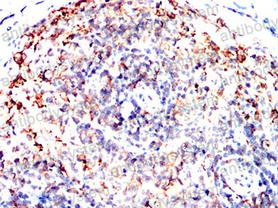 Immunohistochemical for Anti-ABCC3/MRP3 Antibody (R2U63) ?>