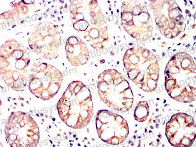 Immunohistochemical for Anti-ABCC3/MRP3 Antibody (R2U63) ?>