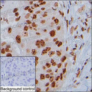 Anti-POLR1G Antibody (R2U67)