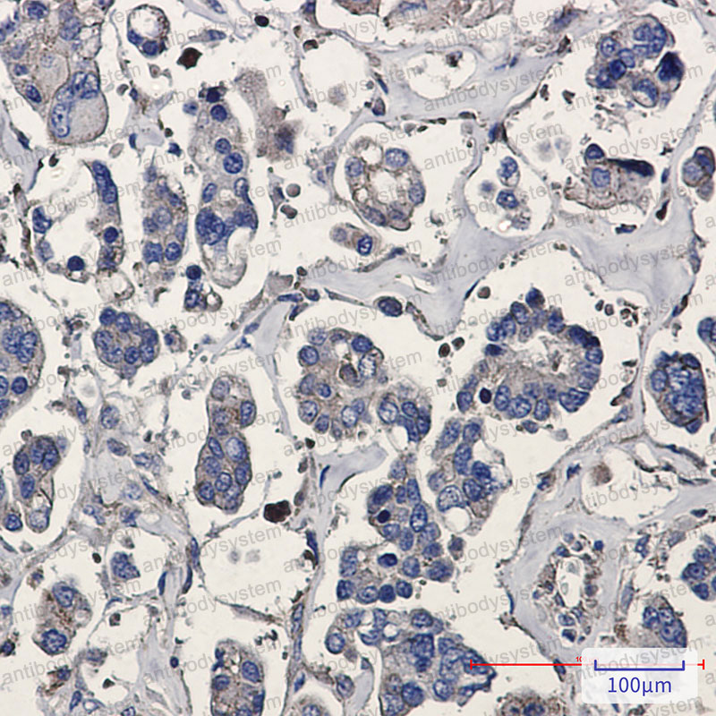 Anti-ARPC5 Antibody (R1D87)