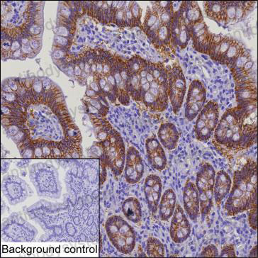 Anti-CLDN3/Claudin-3 Antibody (R2U78)