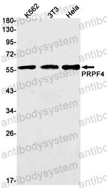 Anti-PRPF4 Antibody (R1D93)