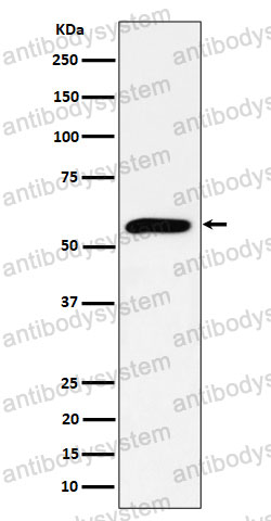 Anti-PRPF4 Antibody (R1D91)