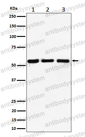 Anti-PRPF4 Antibody (R1D92)